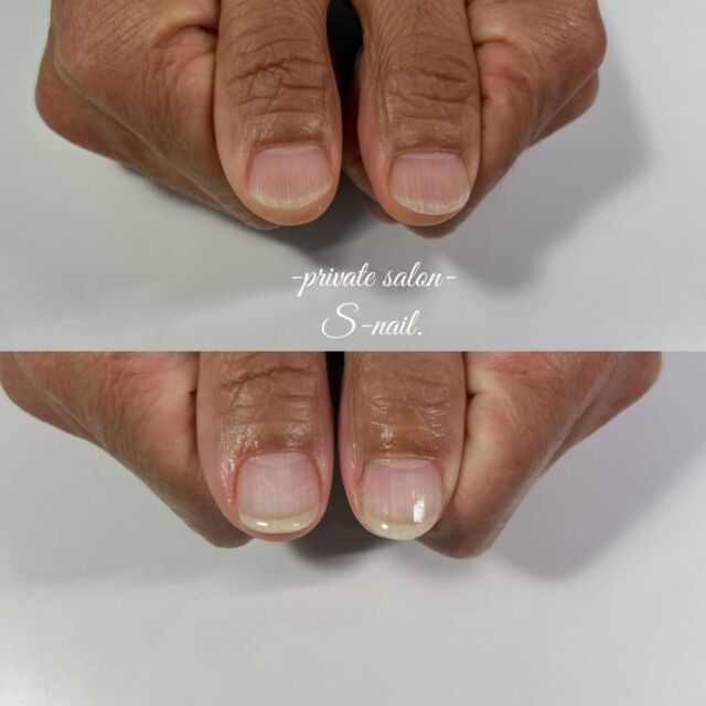 綺麗に伸びています✨
いつもありがとうございます🌼*･
⁡
.
————————————————————
‪

- 深爪矯正/自爪育成に特化したsalon -
.
深爪噛み癖むしり癖凹凸のあるお爪に
お悩みの方ぜひ一度ご相談ください。
.
.
▫️大阪/天王寺区　各線天王寺駅徒歩3分
▫️10:30〜18:00
▫️LINE  @855rjbic
▫️定休日⤑日曜日・月曜日

@fukazume_s_nail
@s_nail0601
private salon S-nail. 

————————————————————

#深爪矯正#深爪#深爪育成#深爪対応サロン
#爪の悩み#深爪サロン#育成サロン#深爪暖和
#深爪ケア#深爪改善#深爪矯正サロン
#メンズ深爪#メンズネイルケア
#自爪育成#自爪育成サロン
#爪育#爪の悩み#爪育成#爪を育てる
#爪ケア#自爪ケア#ネイルケア
#nuancenail#ニュアンスネイル
#爪を育てるネイルサロン
#天王寺ネイルサロン#大阪ネイルサロン
#大阪市ネイルサロン #天王寺
